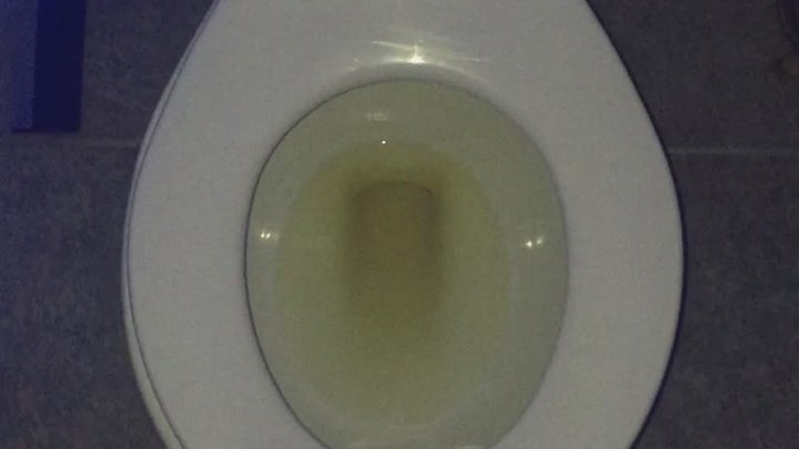 I PEE GOLD $_$