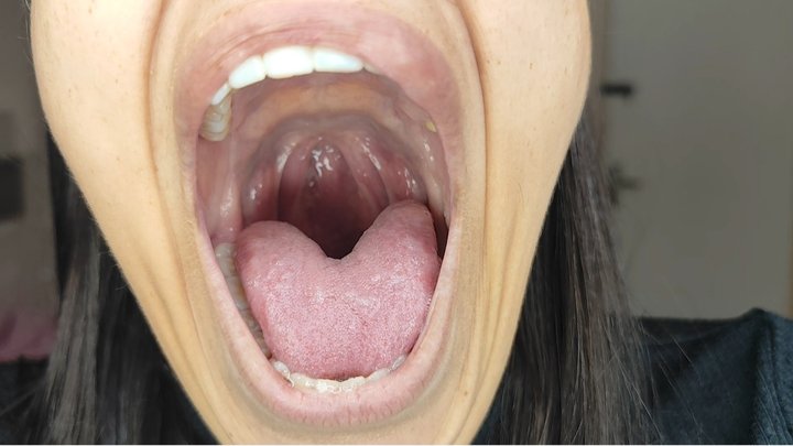 Yawn up close