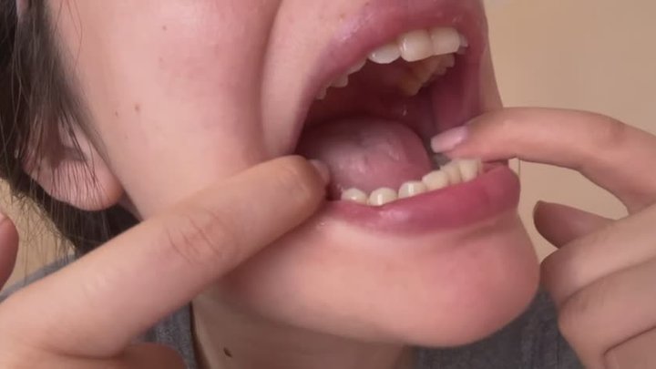 Fresh Missing Tooth & Dancing Uvula: Extreme Mouth Close-Up
