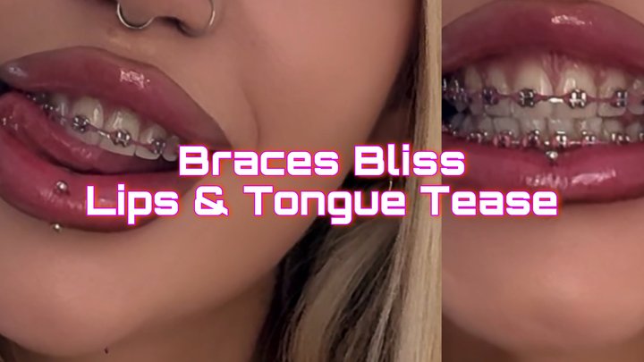 Braces Bliss: Lips & Tongue Tease