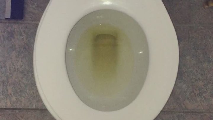 I PEE GOLD IN MY TOILET MSN THE ZONE