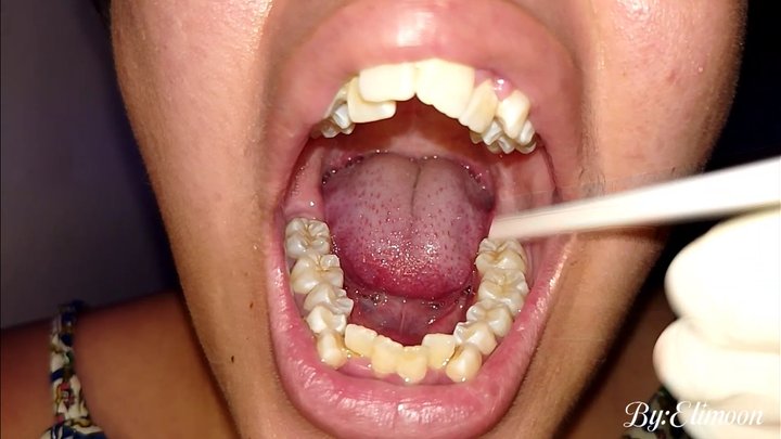 10 days without brushing my teeth. Dirty teeth and lots of saliva? Of course!