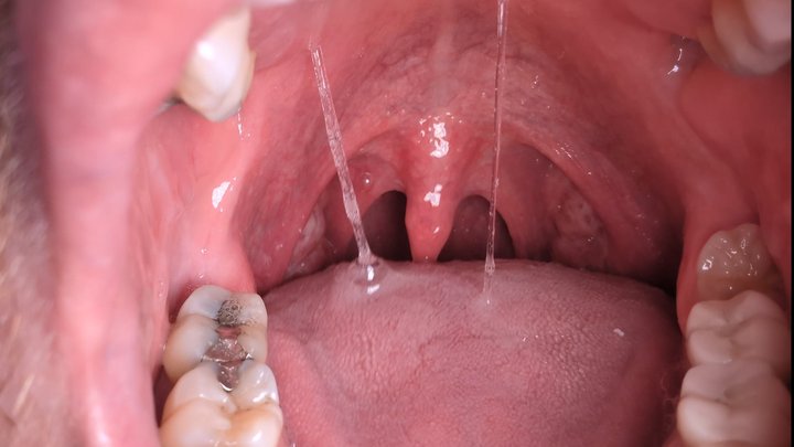 Slow and painful boyfriend vore (Part 2)