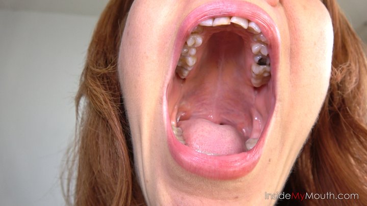 Redhead Titi's Extreme Mouth Tour – Huge Lips, Missing Tooth & Dancing Uvula (FU