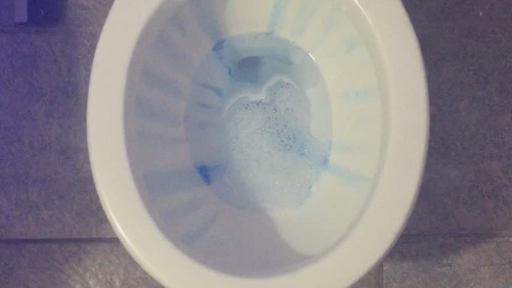 CARNEVAL TOILET TODAY