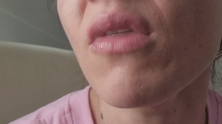 Spitty Lips Triggers