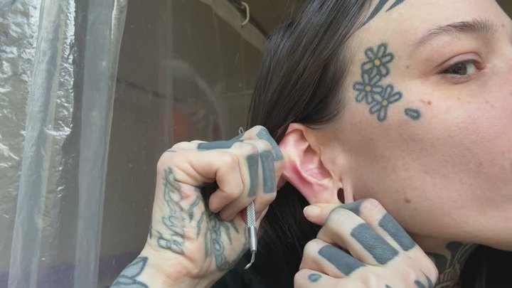 ear blackhead and wax scrape