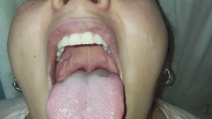 Mostrando mi garganta y mi uvula de cerca.