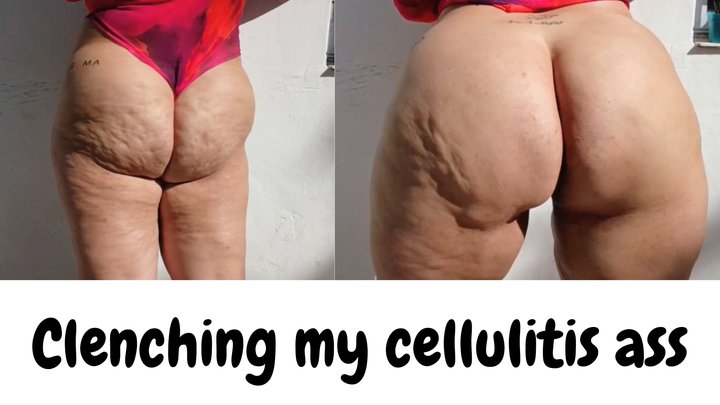 CLENCHING MY CELLULITIS ASS