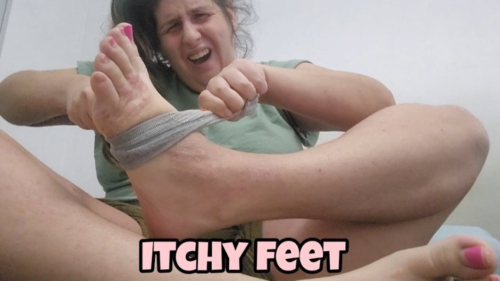 Desperate Itchy Feet: Scratching Hard & Relieving the Itch