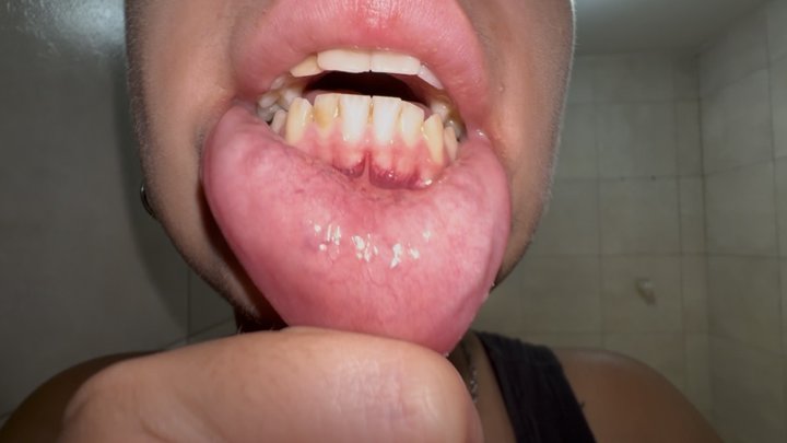 Lip Stretching Close-Up From Different Angles