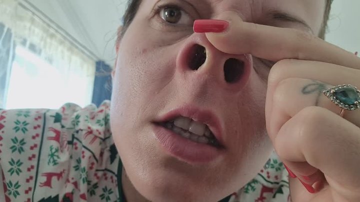 Blow, Pick, Roll & Swallow – My Naughty Nose Habit