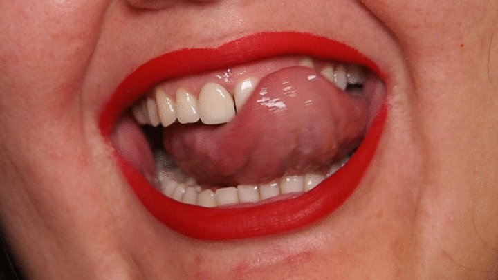 Showing My Teeth