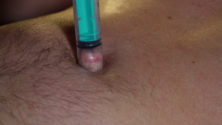 Alex’s Deep Navel: Sucked Out, Pushed Out & Tied Tight