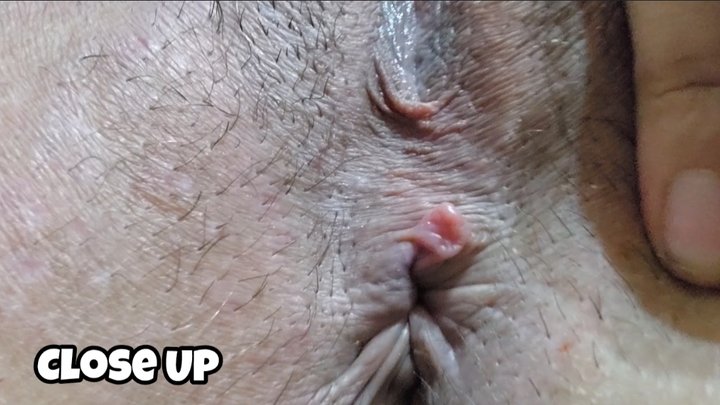 Extreme Butthole Close Up - Asshole Detailed View Chubby Girl