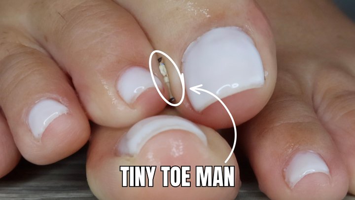 Tiny little toe man - OnlyVanessa