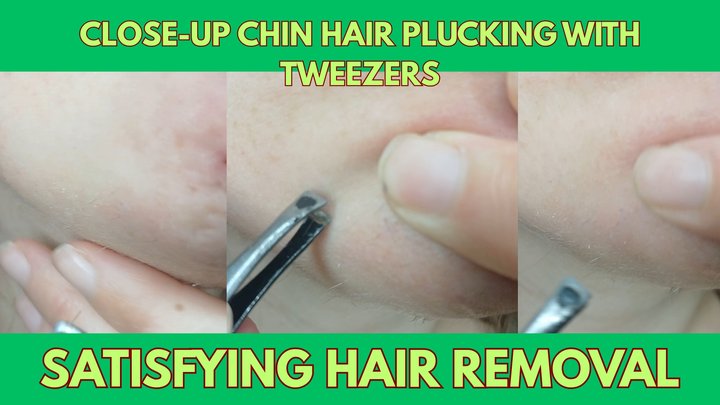 Close-Up Chin Hair Plucking with Tweezers Satisfying Hair Removal