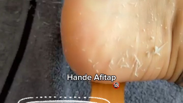 POV | FOOT CARE TIME