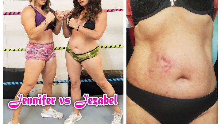 1194 – Belly Attacked! – Bruised & Beaten