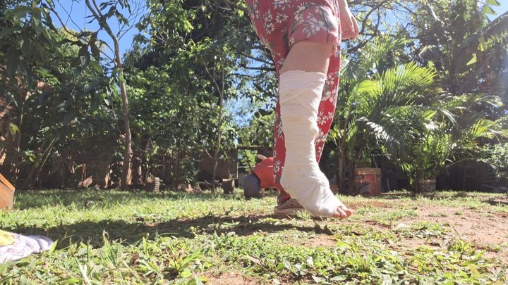 Jessie falls and has a bandaged foot - That hurt!!!