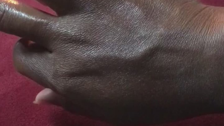 Veinsnthings under candlelight’s playing with veins