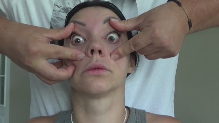 bulging eyes