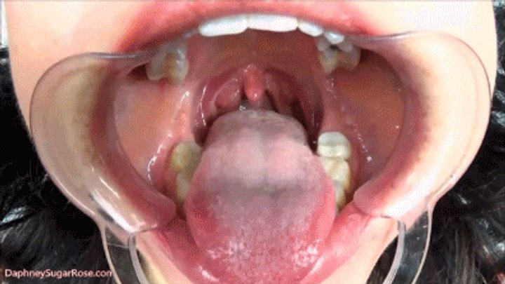 Cheek Retractor Tongue Tease - mP4