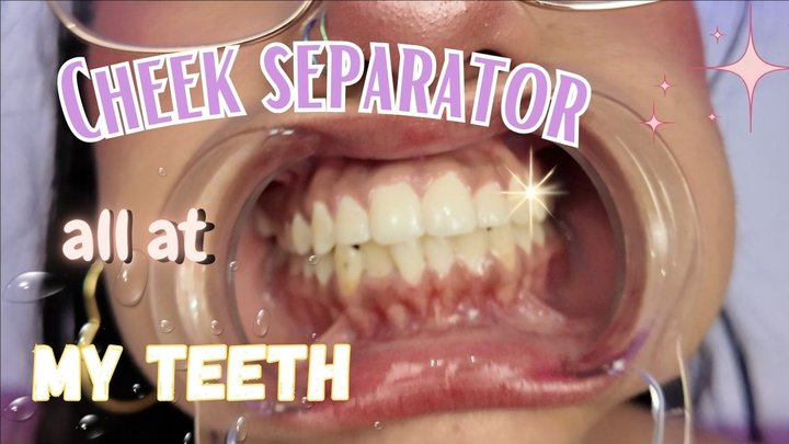 CHEEK SEPARATOR ALL AT MY TEETH