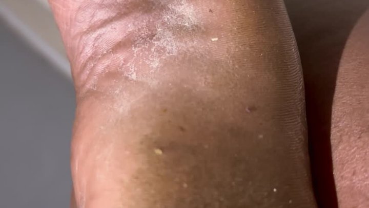 Dirty 10inch foot