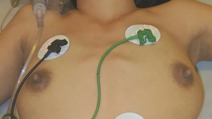 Eva Under Resus – Part 2