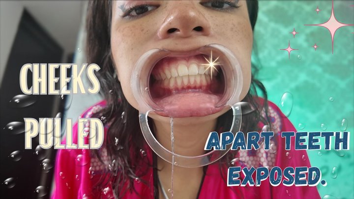 CHEEKS PULLED APART TEETH EXPOSED
