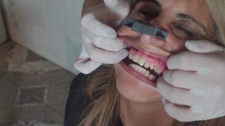 Laly's Sharp Teeth (HD MP4)