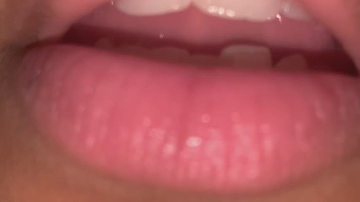 Showing tiny my swollen tonsils